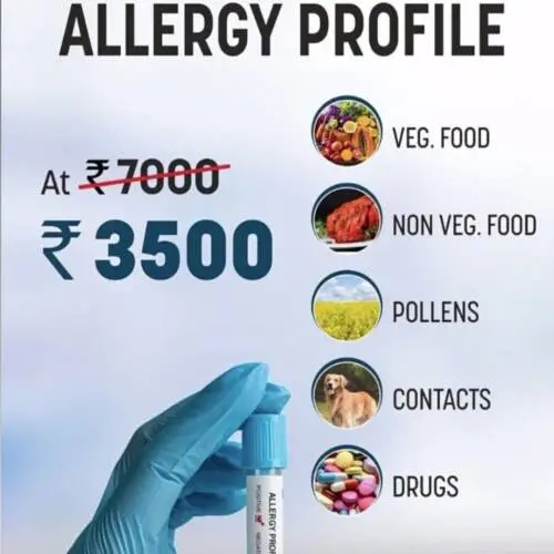 Allergy profile